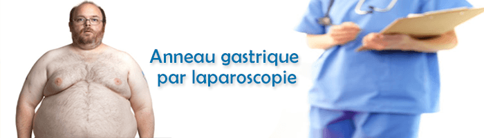 L’anneau gastrique par laparoscopie : déroulement de l’opération et avantages