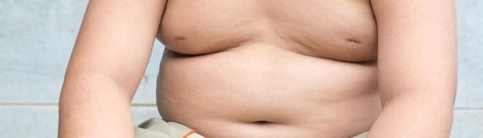 Obésité infantile : risques et prévention