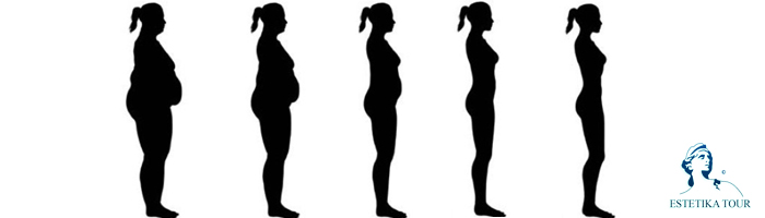 Chirurgie de l’obésité : Risques et effets indésirables