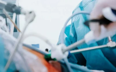 8 Questions fréquentes au sujet de la chirurgie bariatrique