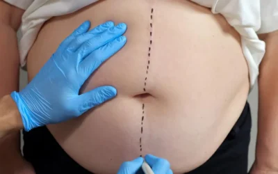 Pilules et injections pour perdre du poids : faut-il s’en méfier ?