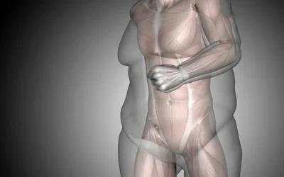4 moyens de maintenir sa masse musculaire après une chirurgie bariatrique