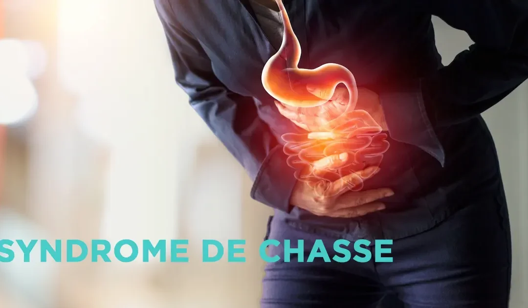 syndrome de chasse