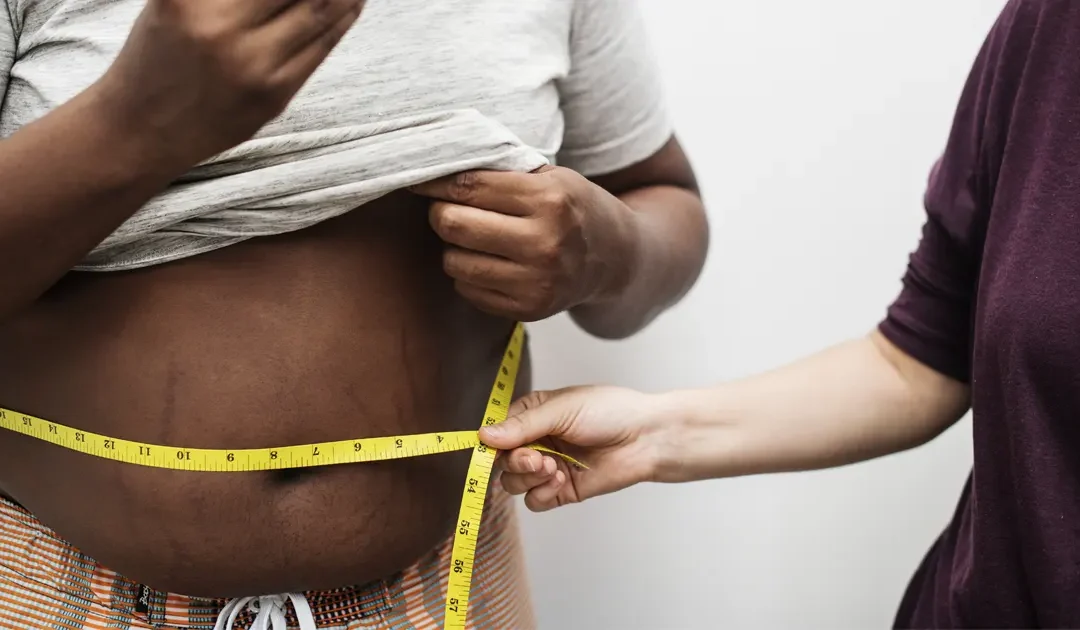 idées reçues au sujet de l’obésité