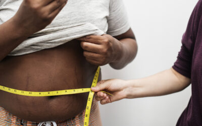 Chirurgie bariatrique : 3 étapes essentielles du processus